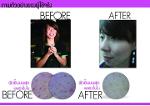 Perfect Melasma Clear Serum ( เพอร์เฟค เมลาสม่า เคลียร์ ซีรั่ม ) 20 ml.